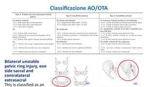 Sac Rating Classifications sacral and pelvic fracture: characteristics and classifications | PPTX
