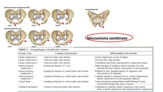 Sac Rating Classifications sacral and pelvic fracture: characteristics and classifications | PPTX
