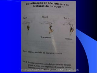 www.traumatologiaeortopedia.com ou www.ortopediabrasil.blogspot.com.br
 