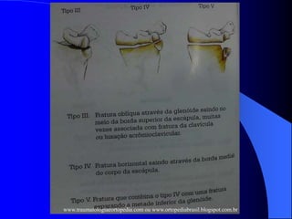 www.traumatologiaeortopedia.com ou www.ortopediabrasil.blogspot.com.br
 
