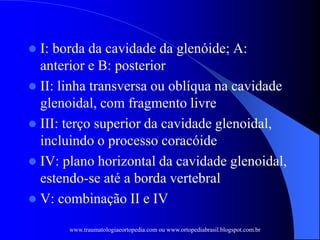  I: borda da cavidade da glenóide; A:
anterior e B: posterior
 II: linha transversa ou oblíqua na cavidade
glenoidal, com fragmento livre
 III: terço superior da cavidade glenoidal,
incluindo o processo coracóide
 IV: plano horizontal da cavidade glenoidal,
estendo-se até a borda vertebral
 V: combinação II e IV
www.traumatologiaeortopedia.com ou www.ortopediabrasil.blogspot.com.br
 