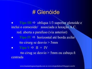 # Glenóide
 Tipo III  obliqua 1/3 superior glenoide e
inclui o corocoide/ associada a luxação A.C.
red. aberta a parafuso (via anterior)
 Tipo IV  horizontal até borda axilar
tto cirurg se desvio > 5mm
 Tipo V  II + IV
tto cirug se desvio > 5mm ou cabeça ñ
centrada
www.traumatologiaeortopedia.com ou www.ortopediabrasil.blogspot.com.br
 