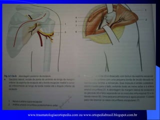 www.traumatologiaeortopedia.com ou www.ortopediabrasil.blogspot.com.br
 