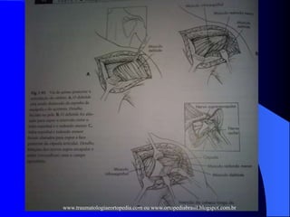 www.traumatologiaeortopedia.com ou www.ortopediabrasil.blogspot.com.br
 