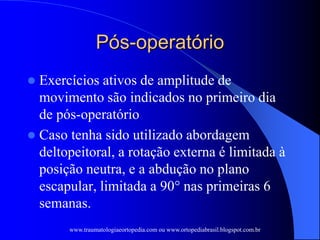 Pós-operatório
 Exercícios ativos de amplitude de
movimento são indicados no primeiro dia
de pós-operatório
 Caso tenha sido utilizado abordagem
deltopeitoral, a rotação externa é limitada à
posição neutra, e a abdução no plano
escapular, limitada a 90° nas primeiras 6
semanas.
www.traumatologiaeortopedia.com ou www.ortopediabrasil.blogspot.com.br
 