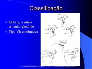 Classificação
 Ideberg: # intra-
articular glenóide
 Tipo VI: cominutiva
www.traumatologiaeortopedia.com ou www.ortopediabrasil.blogspot.com.br
 