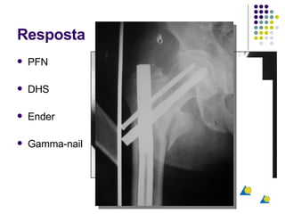 Resposta PFN DHS Ender Gamma-nail 