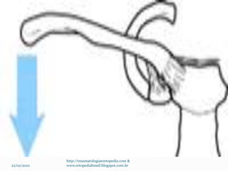 22/02/2020
http://traumatologiaeortopedia.com &
www.ortopediabrasil.blogspot.com.br
 