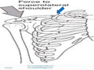 22/02/2020
http://traumatologiaeortopedia.com &
www.ortopediabrasil.blogspot.com.br
 
