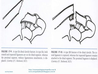 22/02/2020
http://traumatologiaeortopedia.com &
www.ortopediabrasil.blogspot.com.br
 