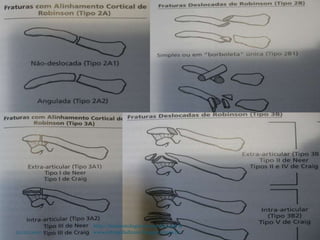 22/02/2020
http://traumatologiaeortopedia.com &
www.ortopediabrasil.blogspot.com.br
 