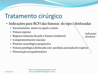 Tratamento cirúrgico
 Indicações para RCFI das fraturas do tipo I deslocadas
 Encurtamento maior ou igual a 20mm
 Fratura exposta
 Ruptura iminente da pele e fratura irredutível
 Comprometimento vascular
 Prejuízo neurológico progressivo
 Fratura patológica deslocada com paralisia associada do trapézio
 Dissociação escapulotorácica
22/02/2020
Indicações
absolutas
http://traumatologiaeortopedia.com &
www.ortopediabrasil.blogspot.com.br
 