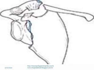 22/02/2020
http://traumatologiaeortopedia.com &
www.ortopediabrasil.blogspot.com.br
 