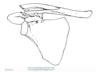 22/02/2020
http://traumatologiaeortopedia.com &
www.ortopediabrasil.blogspot.com.br
 
