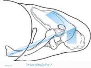22/02/2020
http://traumatologiaeortopedia.com &
www.ortopediabrasil.blogspot.com.br
 
