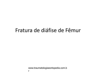 Fratura de diáfise de Fêmur
www.traumatologiaeortopedia.com.b
r
 