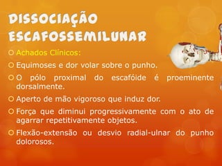  Achados Clínicos:
 Equimoses e dor volar sobre o punho.
 O pólo proximal
dorsalmente.

do

escafóide

é

proeminente

 Aperto de mão vigoroso que induz dor.
 Força que diminui progressivamente com o ato de
agarrar repetitivamente objetos.

 Flexão-extensão ou desvio radial-ulnar do punho
dolorosos.

 