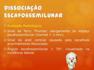  Avaliação Radiológica:
 Sinal de Terry Thomas: alargamento do espaço
escafossemilunar (normal < 3 mm).
 Sinal do anel cortical causado pelo escafóide
anormalmente flexionado.
 Ângulo escafossemilunar > 70°, visualizado na
incidência lateral.

 