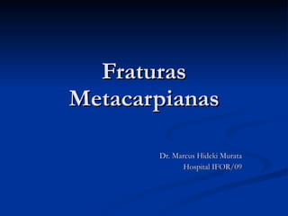 Fraturas Metacarpianas Dr. Marcus Hideki Murata Hospital IFOR/09 