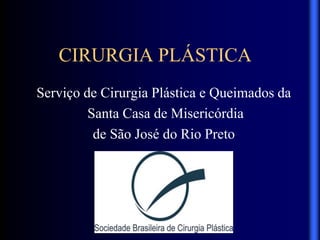 CIRURGIA PLÁSTICA
Serviço de Cirurgia Plástica e Queimados da
Santa Casa de Misericórdia
de São José do Rio Preto
 