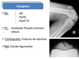 EpidemiologiaImagens:
RX: . AP,
. Perfil,
. Axial (?)
TC: . Avaliação Pseudo-artroses
. Idosos
 Cintilografia: Fraturas de estresse
RM: Estudo ligamentar
 