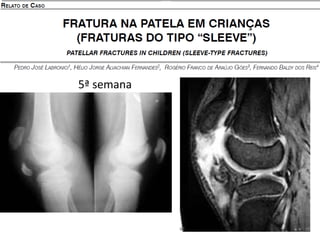 5ª semana
 