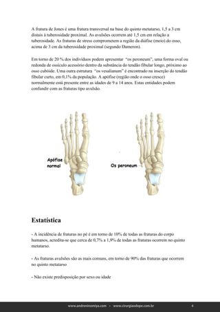 A fratura de Jones é uma fratura transversal na base do quinto metatarso, 1,5 a 3 cm
distais à tuberosidade proximal. As avulsões ocorrem até 1,5 cm em relação a
tuberosidade. As fraturas de stress comprometem a região da diáfise (meio) do osso,
acima de 3 cm da tuberosidade proximal (segundo Dameron).

Em torno de 20 % dos indivíduos podem apresentar “os peroneum”, uma forma oval ou
redonda de ossículo acessório dentro da substância do tendão fibular longo, próximo ao
osso cubóide. Uma outra estrutura “os vesalianum” é encontrado na inserção do tendão
fibular curto, em 0,1% da população. A apófise (região onde o osso cresce)
normalmente está presente entre as idades de 9 a 14 anos. Estas entidades podem
confundir com as fraturas tipo avulsão.




 


Estatística

- A incidência de fraturas no pé é em torno de 10% de todas as fraturas do corpo
humanos, acredita-se que cerca de 0,7% a 1,9% de todas as fraturas ocorrem no quinto
metatarso.

- As fraturas avulsões são as mais comuns, em torno de 90% das fraturas que ocorrem
no quinto metatarso

- Não existe predisposição por sexo ou idade




                                                                                         4
 