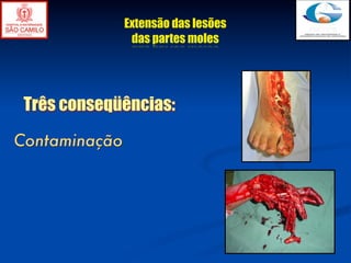 Extensão das lesões
                das partes moles




 Três conseqüências:
Contaminação
 