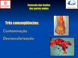 Extensão das lesões
                das partes moles




 Três conseqüências:
Contaminação

Desvascularização
 