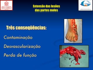 Extensão das lesões
                das partes moles




 Três conseqüências:
Contaminação

Desvascularização

Perda de função
 