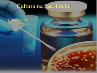 Cultura na fase inicial

 Controverso
 