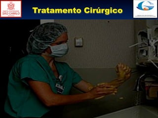Tratamento Cirúrgico
 