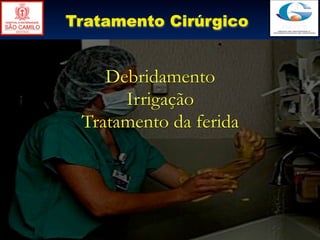 Tratamento Cirúrgico


    Debridamento
      Irrigação
 Tratamento da ferida
 