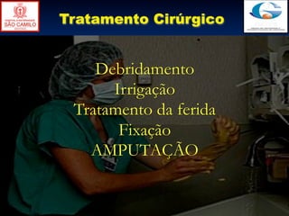 Tratamento Cirúrgico


    Debridamento
      Irrigação
 Tratamento da ferida
       Fixação
   AMPUTAÇÃO
 