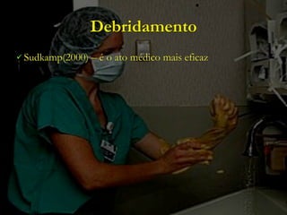 Debridamento
 Sudkamp(2000)   – é o ato médico mais eficaz
 