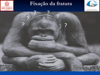 Fixação da fratura
         ?     ?
    ?              ?
?                      ?
 