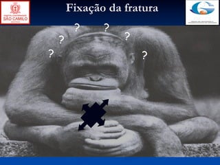Fixação da fratura
         ?     ?
    ?              ?
?                      ?
 