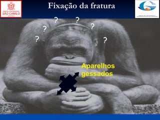 Fixação da fratura
         ?     ?
    ?                ?
?                        ?


                   Aparelhos
                   gessados
 