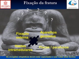 Fixação da fratura
                      ?           ?
                ?                         ?
            ?                                    ?


           Fixação                    Aparelhos
           externa                    gessados

       Hastes                       Placas / parafusos
  intramedulares
Os cirurgiões ortopédicos devem estar capacitados a usar todas estas técnica.
 