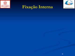 Fixação Interna




                  36
 