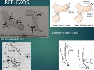 REFLEXOS
BULBOCAVERNOSO S2-S3
BABINSKY E OPPENHEIM
 