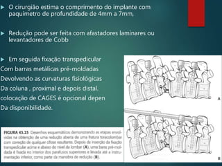  O cirurgião estima o comprimento do implante com
paquímetro de profundidade de 4mm a 7mm,
 Redução pode ser feita com afastadores laminares ou
levantadores de Cobb
 Em seguida fixação transpedicular
Com barras metálicas pré-moldadas
Devolvendo as curvaturas fisiológicas
Da coluna , proximal e depois distal.
colocação de CAGES é opcional depen
Da disponibilidade.
 