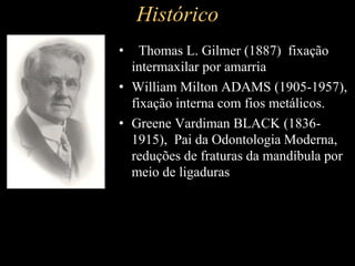 Histórico
• Thomas L. Gilmer (1887) fixação
intermaxilar por amarria
• William Milton ADAMS (1905-1957),
fixação interna com fios metálicos.
• Greene Vardiman BLACK (1836-
1915), Pai da Odontologia Moderna,
reduções de fraturas da mandíbula por
meio de ligaduras
 