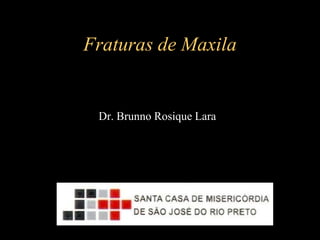 Fraturas de Maxila
Dr. Brunno Rosique Lara
 