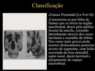 Classificação
●Fratura Piramidal (Le Fort II):
●Caracteriza-se por linha de
fratura que se inicia na região
nasofrontal, desce pela apófise
frontal da maxila, correndo
lateralmente através dos ossos
lacrimais e assoalho da órbita.
Nos casos mais graves pode
ocorrer deslocamento posterior
severo do segmento, com lesão
associada da área etmoidal,
septo nasal, ducto lacrimal e
alargamento do espaço
interorbital.
 