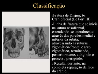 Classificação
●Fratura de Disjunção
Craniofacial (Le Fort III):
●Linha de fratura que se inicia
na sutura nasofrontal,
estendendo-se lateralmente
através das paredes medial e
inferior da órbita,
atravessando as suturas
zigomático-frontal e arco
zigomático, terminando,
posteriormente, atingindo o
processo pterigóide.
● Resulta, portanto, na
completa separação da face
do crânio.
 