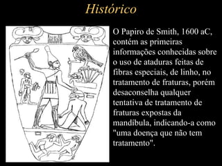 Histórico
• O Papiro de Smith, 1600 aC,
contém as primeiras
informações conhecidas sobre
o uso de ataduras feitas de
fibras especiais, de linho, no
tratamento de fraturas, porém
desaconselha qualquer
tentativa de tratamento de
fraturas expostas da
mandíbula, indicando-a como
"uma doença que não tem
tratamento".
 