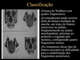 Classificação
●Fratura de Walthers (em
quatro fragmentos):
●Eventualmente pode ocorrer,
além da fratura mediana da
maxila, um traço de fratura
transverso no palato,
freqüentemente na sutura
maxilopalatal, próximo ao
primeiro e segundo pré-
molares, configurando quatro
fragmentos ósseos.
●No tratamento desse tipo de
fratura encontra-se dificuldade
para a estabilização dos
fragmentos posteriores.
 