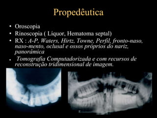 Propedêutica
• Oroscopia
• Rinoscopia ( Líquor, Hematoma septal)
• RX : A-P, Waters, Hirtz, Towne, Perfil, fronto-naso,
naso-mento, oclusal e ossos próprios do nariz,
panorâmica
● Tomografia Computadorizada e com recursos de
reconstrução tridimensional de imagem.
 