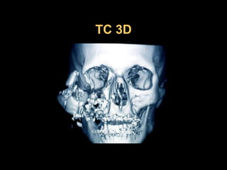 TC 3D
 